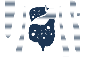 Xpert® GI Panel: rychlá diagnostika gastrointestinálních patogenů na platformě GeneXpert 