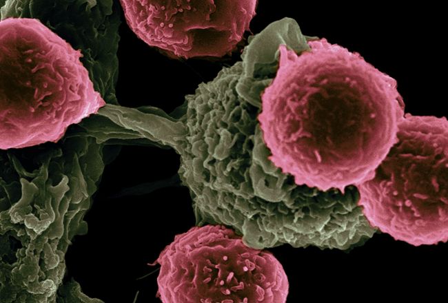 Somatic Mutation NGS Assay